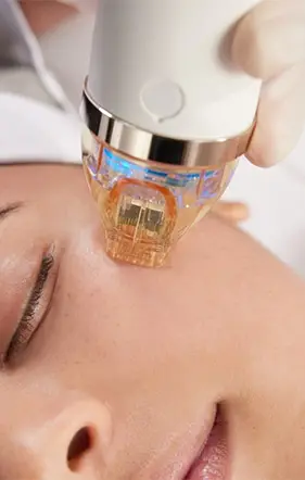 A woman is receiving the microneedling treatment by an esthetician